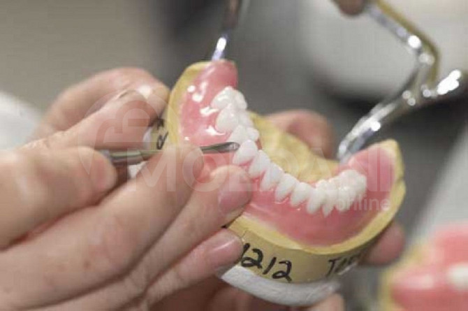 კბილის პროთეზის დამზადება თბილისი - photo 1