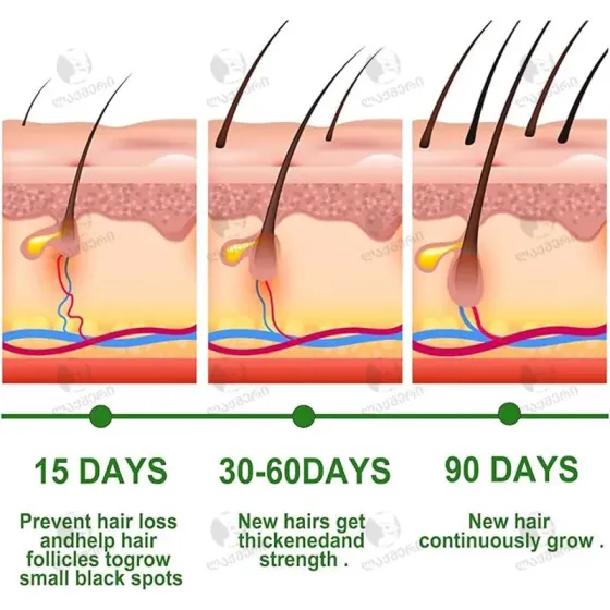 Масло для волос Mielle с розмарином (59 мл) Тбилиси
