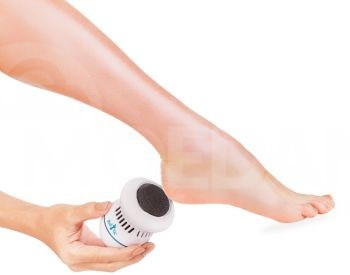 Electric blackhead remover Find Back Tbilisi - photo 4