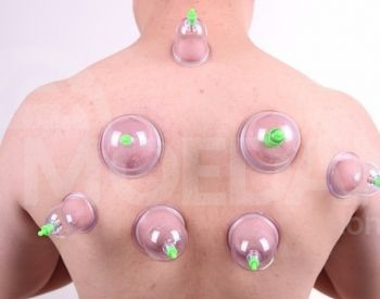 მასაჟის ვაკუუმის ქილები 12 ც თბილისი - photo 4