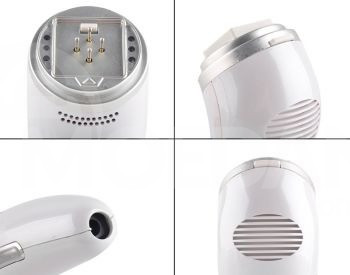 RF (რადიოსიხშირული) ლიფტინგი თბილისი - photo 4