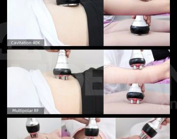 40K ultrasonic cavitation device with 3 functions Tbilisi - photo 3