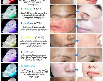 Косметическая светодиодная маска Тбилиси - изображение 3