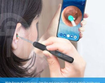 Отоскоп ушной эндоскоп Тбилиси - изображение 2