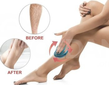 მექანიკური ეპილატორი თბილისი - photo 3