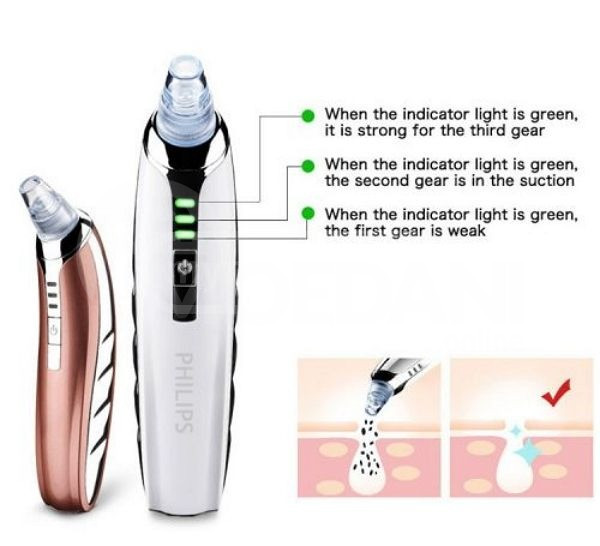 ფერიმჭამელების მოსაშორებელი თბილისი - photo 1