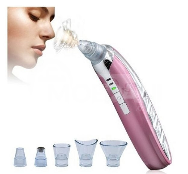 ფერიმჭამელების მოსაშორებელი თბილისი - photo 2