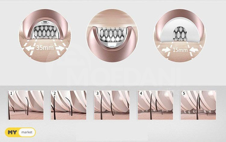 Epilator Tbilisi - photo 4