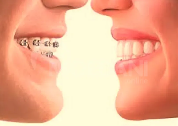 Ортодонт Тбилиси - изображение 1