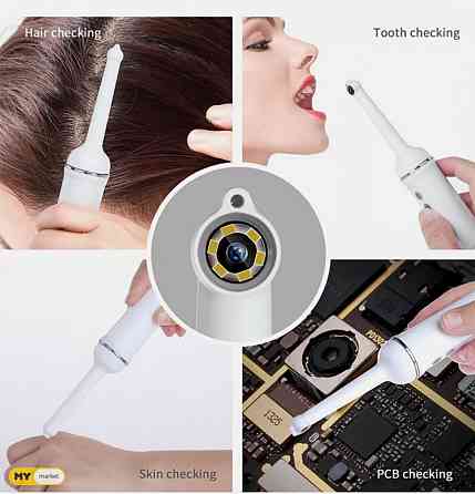 wifi camera dental Tbilisi